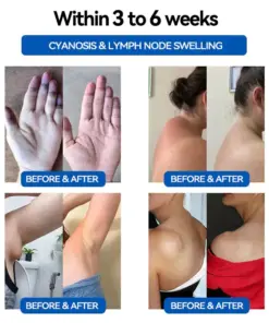 𝐓𝐀𝐈𝐋𝐄𝐃𝐄𝐍™ 𝐔𝐥𝐭𝐫𝐚𝐬𝐨𝐧𝐢𝐜 𝐅𝐚𝐭 𝐁𝐥𝐚𝐬𝐭𝐢𝐧𝐠 & 𝐃𝐞𝐞𝐩 𝐈𝐧𝐟𝐫𝐚𝐫𝐞𝐝 𝐁𝐥𝐨𝐨𝐝 𝐒𝐮𝐠𝐚𝐫 𝐁𝐚𝐥𝐚𝐧𝐜𝐢𝐧𝐠 𝐃𝐞𝐭𝐨𝐱 𝐖𝐫𝐢𝐬𝐭𝐛𝐚𝐧𝐝