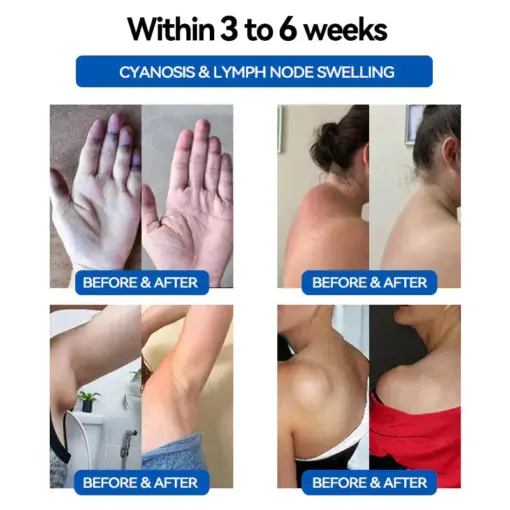 𝐓𝐀𝐈𝐋𝐄𝐃𝐄𝐍™ 𝐔𝐥𝐭𝐫𝐚𝐬𝐨𝐧𝐢𝐜 𝐅𝐚𝐭 𝐁𝐥𝐚𝐬𝐭𝐢𝐧𝐠 & 𝐃𝐞𝐞𝐩 𝐈𝐧𝐟𝐫𝐚𝐫𝐞𝐝 𝐁𝐥𝐨𝐨𝐝 𝐒𝐮𝐠𝐚𝐫 𝐁𝐚𝐥𝐚𝐧𝐜𝐢𝐧𝐠 𝐃𝐞𝐭𝐨𝐱 𝐖𝐫𝐢𝐬𝐭𝐛𝐚𝐧𝐝