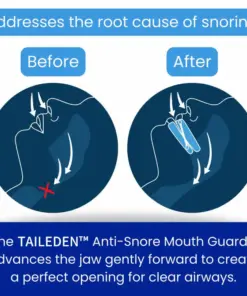 TAILEDEN™ Anti-Snore Mouth Guard+