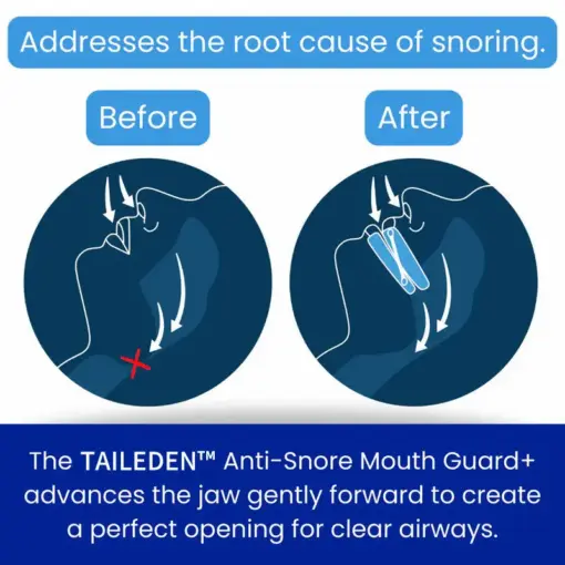 TAILEDEN™ Anti-Snore Mouth Guard+