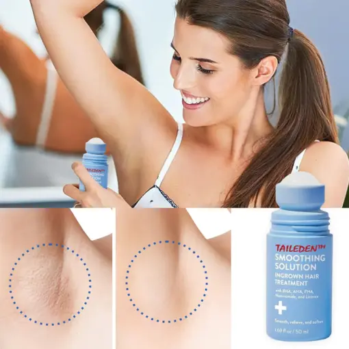TAILEDEN™ Smoothing Solution Ingrown Hair Treatment