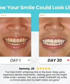 Missing TAILEDEN™ UltraBite