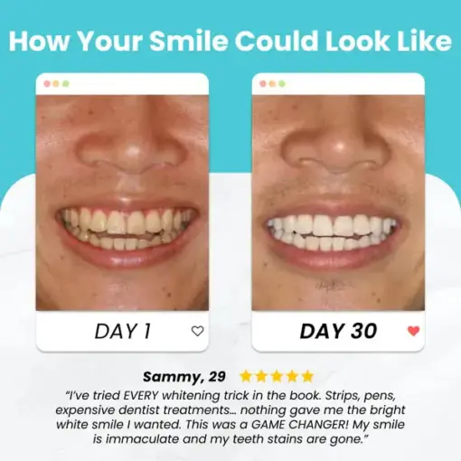 Missing TAILEDEN™ UltraBite