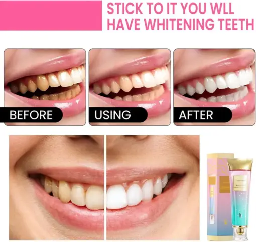 TAILEDEN™ Niacinamide Whitening Toothpaste