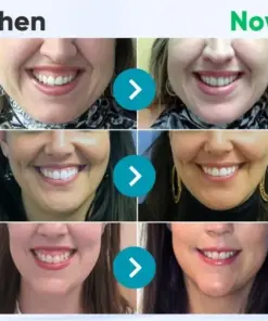Taileden™ Gum Therapy Gel