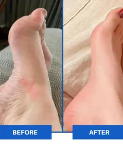 TAILEDEN™ Advanced EMS Foot Massager