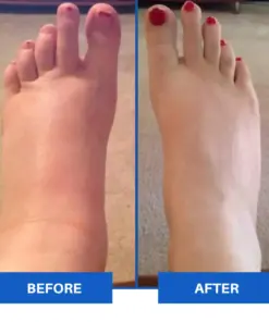 TAILEDEN™ Advanced EMS Foot Massager