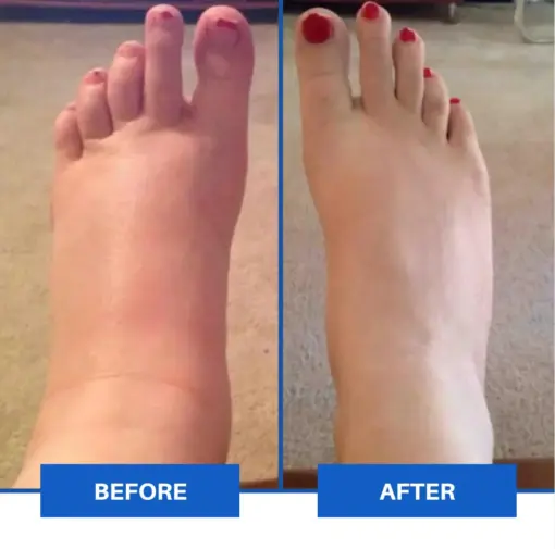 TAILEDEN™ Advanced EMS Foot Massager