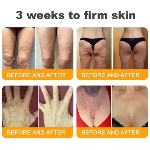 TAILEDEN® Bee Venom Skin Restoration Cream
