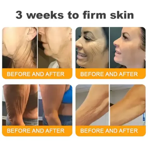 TAILEDEN® Bee Venom Skin Restoration Cream