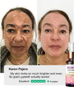 TAILEDEN® MelantraX Advanced Brightening Essence ACE