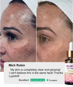 TAILEDEN® MelantraX Advanced Brightening Essence ACE
