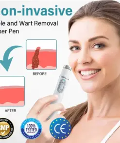 TAILEDEN Painless Laser Mole Removal Pen