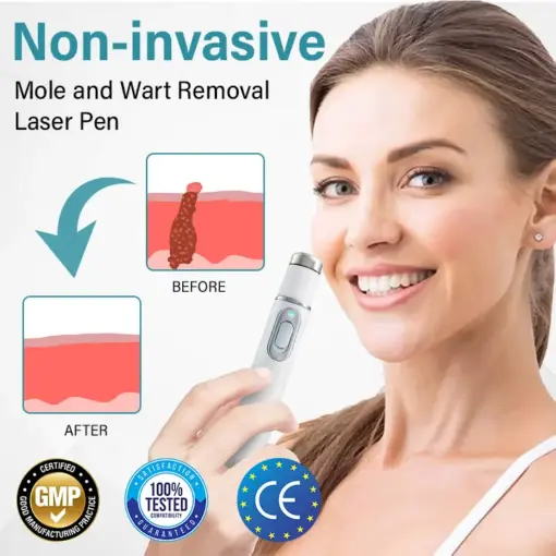 TAILEDEN Painless Laser Mole Removal Pen