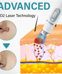 TAILEDEN Painless Laser Mole Removal Pen