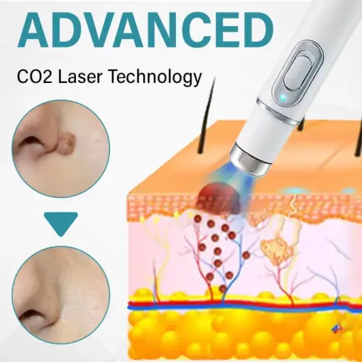 TAILEDEN Painless Laser Mole Removal Pen