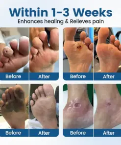 TAILEDEN® AngioVita Diabetic Care Spray