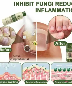 𝗧𝗔𝗜𝗟𝗘𝗗𝗘𝗡® 𝗠𝗮𝗴𝗻𝗲𝘀𝗶𝘂𝗺 𝗛𝗲𝗿𝗯𝗮𝗹 𝗣𝘀𝗼𝗿𝗶𝗮𝘀𝗶𝘀 𝗦𝗽𝗿𝗮𝘆