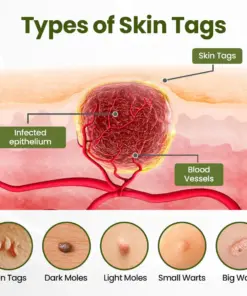 TAILEDEN® MagneErase Renewal Cream