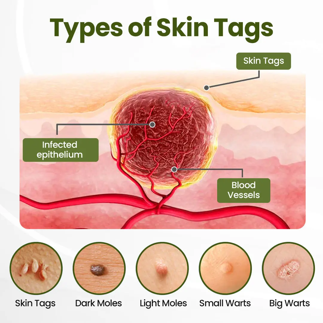 TAILEDEN® MagneErase Renewal Cream