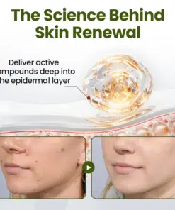 TAILEDEN® MagneErase Renewal Cream