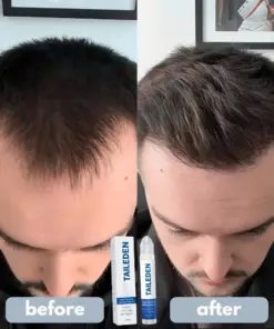 TAILEDEN Pro-Growth Roll-On Hair Growth Serum