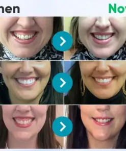 TAILEDEN®Bee Venom Dental Treatment Toothpaste-Comprehensive Oral Care Solutions