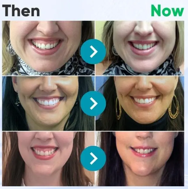 TAILEDEN®Bee Venom Dental Treatment Toothpaste-Comprehensive Oral Care Solutions