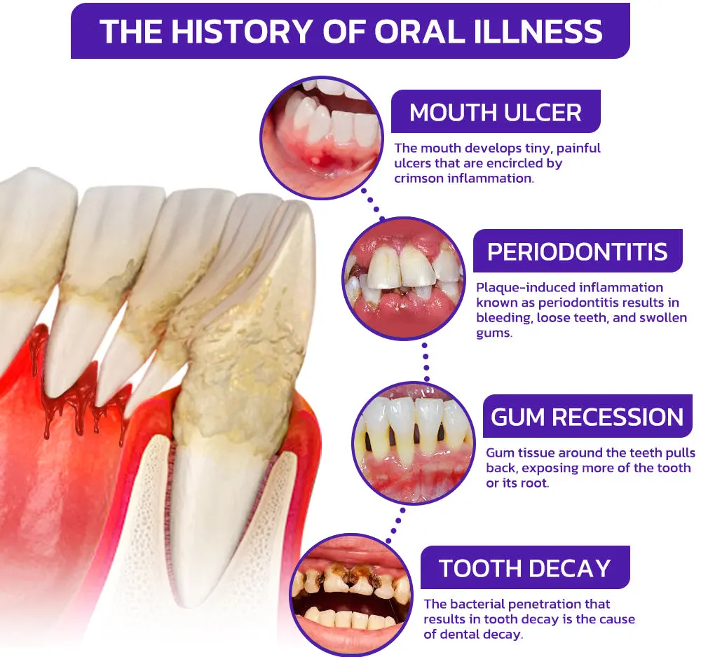 TAILEDEN®Bee Venom Dental Treatment Toothpaste-Comprehensive Oral Care Solutions