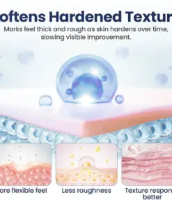 TAILEDEN™ Texture Repair Gel