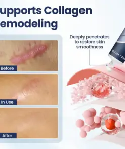 TAILEDEN™ Texture Repair Gel