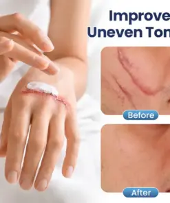 TAILEDEN™ Texture Repair Gel