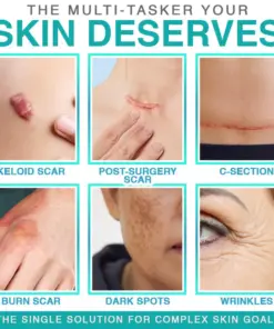 TAILEDEN™ 3-in-1 Microneedle Care Patch