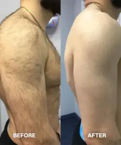 TAILEDEN™ Hair Removal Cream for All Women & Men