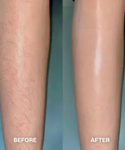 TAILEDEN™ Hair Removal Cream for All Women & Men