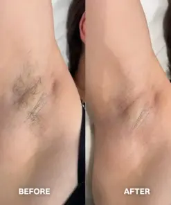 TAILEDEN™ Hair Removal Cream for All Women & Men