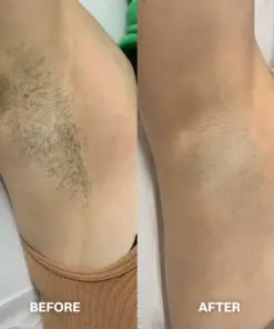 TAILEDEN™ Hair Removal Cream for All Women & Men