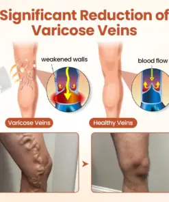 TAILEDEN™ VeinTarget Microneedle Patch