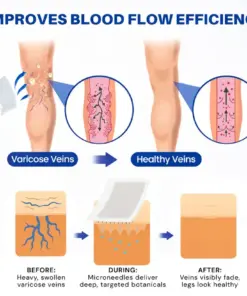 TAILEDEN® 𝑽𝗲𝗶𝙣 𝘾𝐨𝐧𝘁𝗼𝙪𝙧 𝙈𝙞𝐜𝐫𝒐𝒏𝒆𝗲𝗱𝗹𝙚 𝙋𝙖𝐭𝐜𝒉