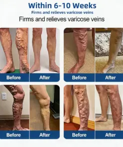 TAILEDEN® 𝑽𝗲𝗶𝙣 𝘾𝐨𝐧𝘁𝗼𝙪𝙧 𝙈𝙞𝐜𝐫𝒐𝒏𝒆𝗲𝗱𝗹𝙚 𝙋𝙖𝐭𝐜𝒉