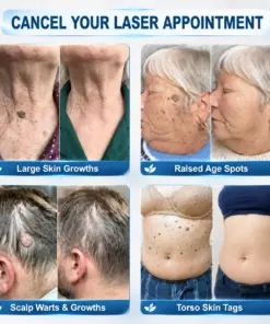 TAILEDEN® 7-Day Skin Tag & Spot Eraser Painless & Scar-Free Advanced Imperfection Removal Rollerball Pen