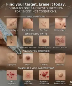TAILEDEN® 7-Day Skin Tag & Spot Eraser Painless & Scar-Free Advanced Imperfection Removal Rollerball Pen