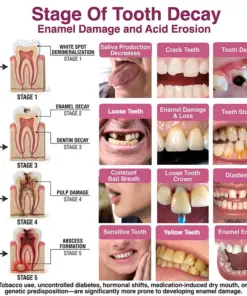 TAILEDEN® Cavity-Repair Natural Enamel Filling Gel